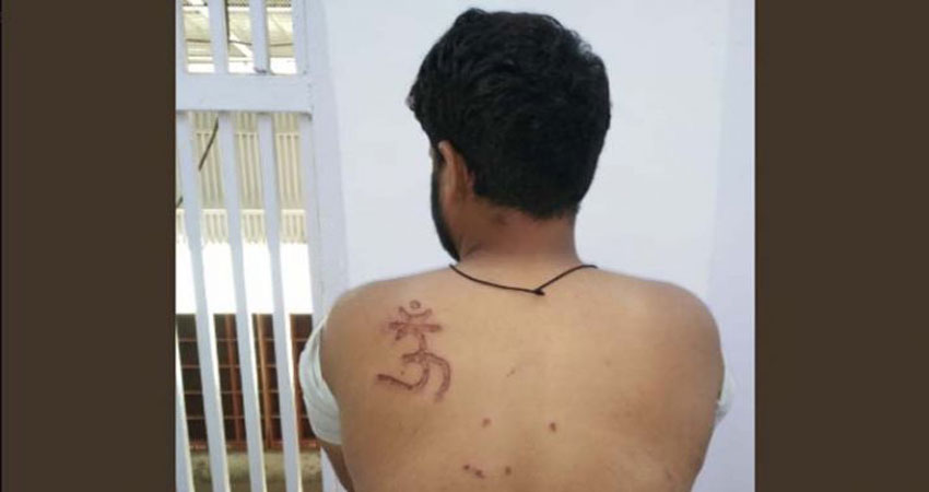 तिहाड़ जेल में मुस्लिम कैदी की पीठ पर जबरन बनाया ‘ओम’, कोर्ट ने मांगी रिपोर्ट तिहाड़ जेल में मुस्लिम कैदी की पीठ पर जबरन बनाया ‘ओम’, कोर्ट ने मांगी रिपोर्ट