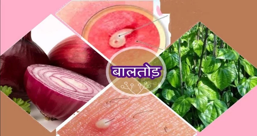 इन घरेलू नुस्खों से पाएं चुटकियों में बालतोड़ की समस्या से राहत इन घरेलू नुस्खों से पाएं चुटकियों में बालतोड़ की समस्या से राहत